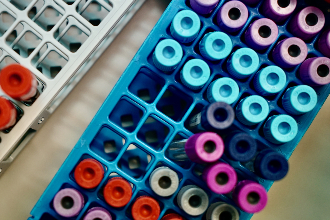 Mostres de laboratori